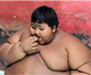 印尼10岁男孩重384斤 为世界最胖男孩